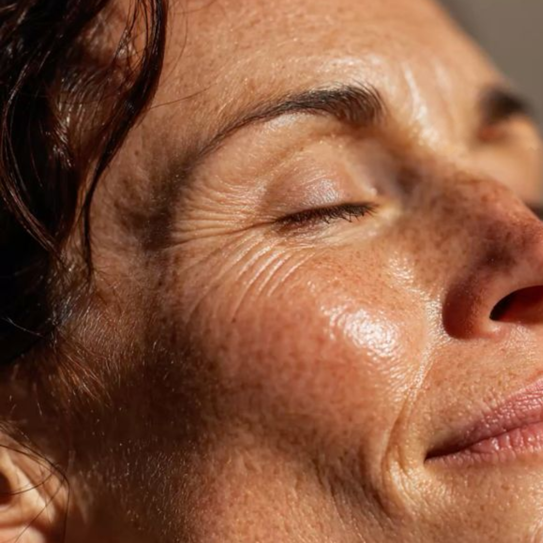 Wrinkles & Fine Lines