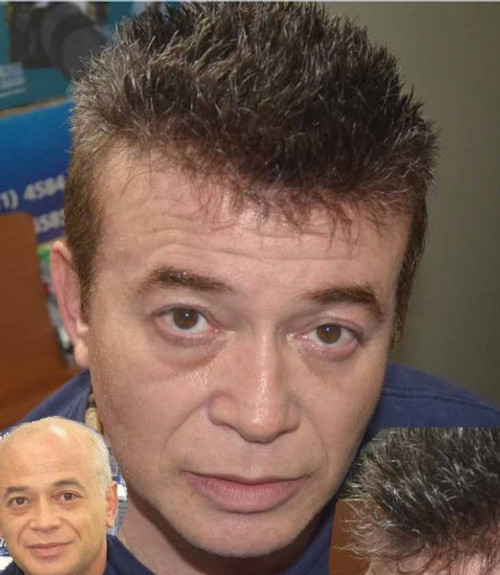 Zigzag male toupee Clearance