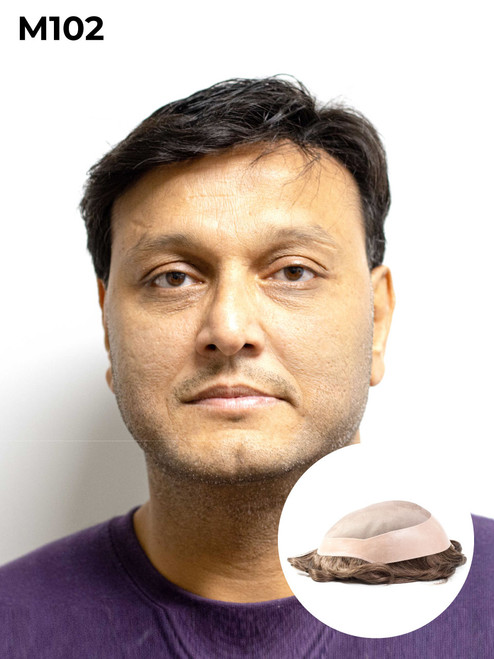 monofilament hair system for men