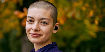 Hairs To You Podcast: Alopecia, misconceptions and how to combat it