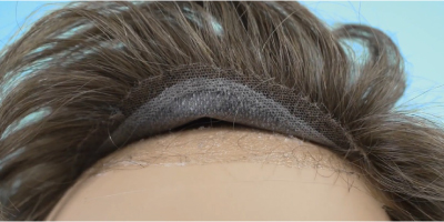 How to fix your hairline if the hair system lifts