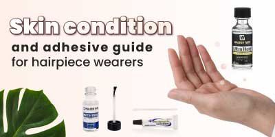 Skin condition and adhesive guide for hairpiece wearers