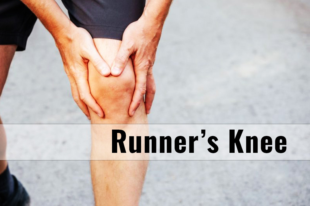 Understanding and Treating Runner's Knee - Kbands Training