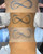 Laser Tattoo Removal Laser Tattoo Removal