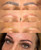 Laser Tattoo Removal Laser Tattoo Removal