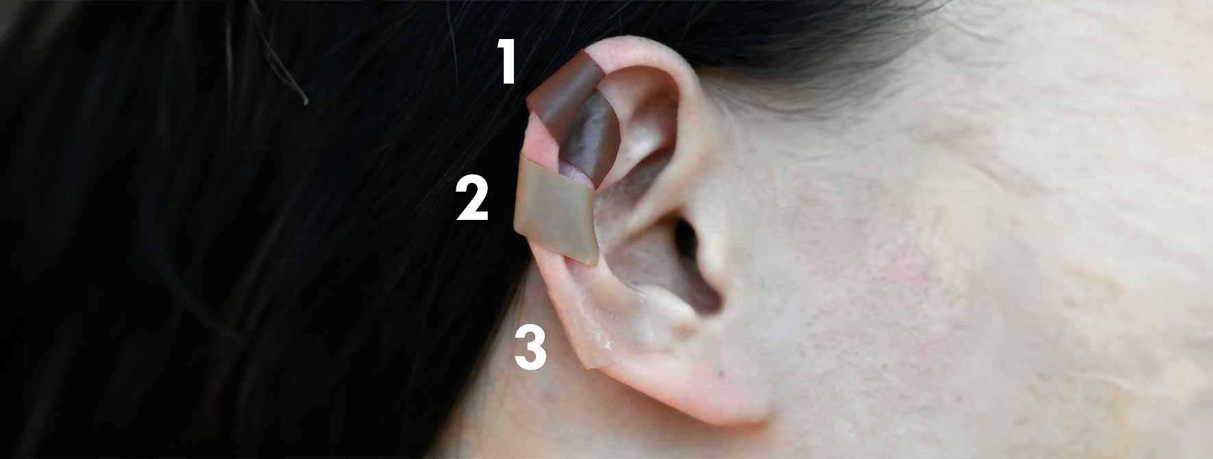 Keloid Magnetic Earrings offers strong pressure on the ear lobes.