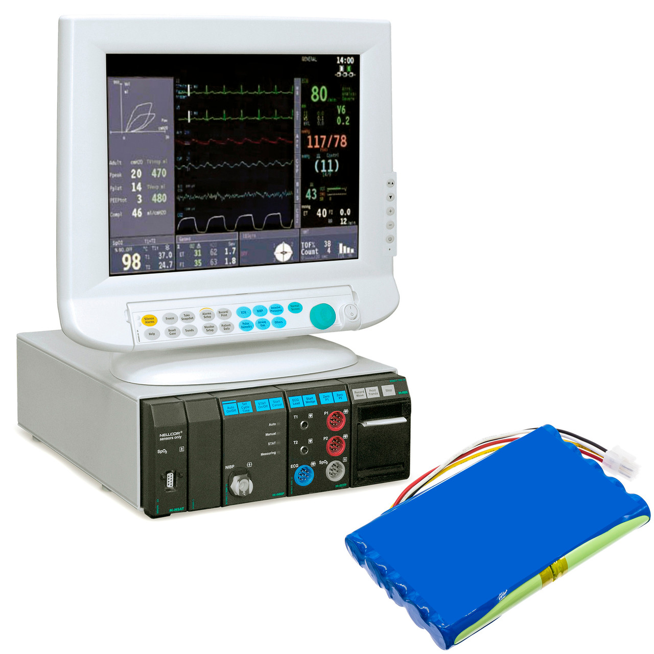 Datex-Ohmeda S/5 Patient Monitor Battery