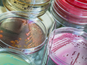 Do I need a Preservative Efficacy Test?