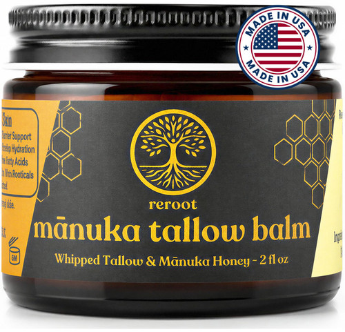 Manuka Honey Beef Tallow for Skin ~2 INGREDIENTS~ 100% Grass-Fed Tallow and Honey Balm - Whipped & UNSCENTED Tallow Face Moisturizer - Hydrating Tallow Balm for Men, Women, Kids & Babies (2oz)