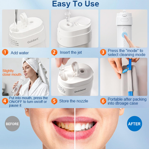 GOLDANT 2026 New Portable Water Flosser for Teeth, 4 Modes & 4 Intensity Levels, Mini Small Design with Exquisite Travel Case, Removable Tank, IPX7 Waterproof, Cordless Dental Oral Irrigator (Black)