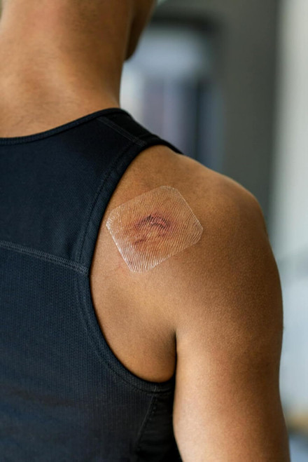 Nexcare Tegaderm Transparent Dressing, Clear Film Lets You See Wounds Heal, Waterproof Dressing Holds Fast for 7 Days - 10 Dressings, 3-Pack
