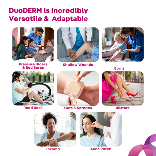 ConvaTec DuoDERM Control Gel Formula 8"x8" Hydrocolloid Sterile Adhesive Dressing for Partial and Full-Thickness Wounds, Medical Grade, Latex-Free, Waterproof, Square, Beige, 5ct Box