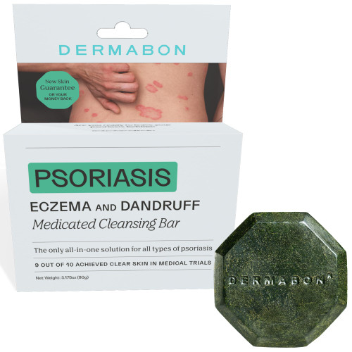 Coal Tar Soap for Psoriasis & Eczema - Dermatitis Relief Bar Soap 3.175 oz