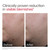 EltaMD UV Clear Blemish-Prone & Oil Balancing SPF 50, Non-Comedogenic Sunscreen with Zinc Oxide, Dermatologist Recommended