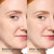 EltaMD UV Clear Face Sunscreen SPF, Oil-Free Sunscreen with Zinc Oxide, Dermatologist Recommended