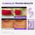 CENTELLIAN 24 PDRN Face & Eye Set (4pcs) – PDRN Cream 1.69 fl oz + Eye Cream 1.01 fl oz + Eye Patches (1pair x 2ea) + Active Serum 1.69 fl oz, TECA PDRN, Firming, Hydrating, Anti Aging Korean Skincare