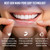 GuruNanda Teeth Whitening Strips Kit - 30-Day Treatment with Non-Slip, Dry Strip Technology - Whitening Designed with Care for a Brighter Smile