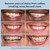 Auraglow Teeth Whitening Gel for Toothpaste, 9% Hydrogen Peroxide, Add to Toothpaste to Whiten, 350+ Whitening Treatments, Removes Coffee Wine Tea Stains, No Trays or Strips, Made in USA, 2.6oz