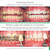 Opalescence Go 10% - Prefilled Teeth Whitening Trays Kit (10 Treatments) - 10% Hydrogen Peroxide - Mint Made by Ultradent Products. Go Teeth Whitening Kit -Mint- GO10-5193-1