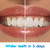 Crest 3D White Advanced Teeth Whitening Toothpaste, Radiant Mint, 3.3 oz, Pack of 12