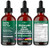 Thyroid Support Drops - Selenium, Zinc, Iodine, L Tyrosine, Ashwagandha, Turmeric, Schisandra Guggu, Cayenne, Basil - Liquid Supplement Folate Copper Alcohol -Free, Vegan, Non-GMO – 4 oz