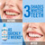 GuruNanda Whitening Mouthwash – Up to 3 Shades Whiter Teeth in 2 Weeks – Alcohol & Fluoride Free with Hydrogen Peroxide – Oxyburst Technology - Wild Mint, 33.8 oz/ 1 Liter (Pack of 2)