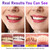 Teeth Whitening Powder - Teeth Whitening - Removes Stains - No Sensitivity - Toothpaste Power - Breath Freshener - for Coffee, Tea and Tobacco Stains 15g