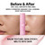 Pink Collagen Multi Balm with PDRN | Volufiline Collagen Stick, NAD & Vitamin E | Smooths Fine Lines on Under-Eyes, Neck, Forehead, Smile Lines, Lips & Body | Dewy & Quick Hydration | Travel-Friendly
