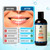 Natruveda Coconut Oil Pulling Mouthwash – 40 oz (Pack of 4), Extra Virgin Coconut Oil, Mint Flavor, Oil Pulling for Teeth & Gums, Natural Mouthwash, Whitening Oral Rinse, Ayurvedic Pulling Oil