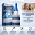 THESHYING Official Professional Grade Dental Lab Instant Bonding Dental Glue for Dentures & Lab Tools - Fast-Setting in 15-60 Sec | Crack Repair & Gap Filling | Long-Lasting Hold (Days to Weeks) – 1oz