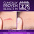 Cicatricure Advanced Scar Gel for Face & Body - Proven Results in 2 Weeks, Scar Treatment for Surgical Scars, Stretch Marks, Scars of Burns and Injuries, Acne Scar Treatment, 1 oz (28 g) - Pack of 3