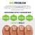 Toenail Fungus Treatment Extra Strength - for fingernails, nail repair, toenail softener, yellow toenail treatment, ingrown nail and foot fungus treatment extra strength