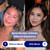 IBLUSH Alcohol Flush Patches – Discreet, Easy-to-Wear Support for Redness & Drinking Discomfort | Non-Ingestible Option for Asian Glow & Alcohol Sensitivity | 12 Patches