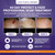 Biocorneum Advanced Scar Treatment – Silicone Scar Gel with SPF 30 & Silishield® 20g – Scar Cream for Surgical Scars, C-Section & Acne – Fast Drying, Water Resistant Scar Removal Gel for Children