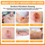 Carbou Medical Xeroform Petrolatum Dressing 1"x8", 50 Pack, Non-Stick Gauze