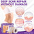 Silicone Scar Sheets, Silicone Scar Tape(1.6"x 197" Roll-5M)