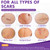 Silicone Scar Sheets, Silicone Scar Tape(1.6"x 197" Roll-5M)