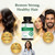 Natural Wellbeing Hair Essentials – DHT Blocker Hair Growth Supplement for Women & Men – Saw Palmetto, Biotin, – Vegan Capsules – Stops Shedding & Thinning (90 Count, 1-Month Supply)