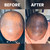 Rennora Hair Growth Serum with Peppermint, Nettle & Rosemary Oil (4 Pack)