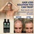 Moerie Hair Growth Shampoo for Men and Women, Hair Loss Solution with Biotin and Rosemary, Thickening Shampoo for Thinning Hair – Ultimate Boost for All Hair Types