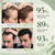 BSAPY Usman Hair Growth Shampoo Bar for Thinning Hair, 2-Pack, 4.2 oz Each | Herbal Scalp Revival Care for Stronger, Thicker & Fuller-Looking Hair, Free of Sulfates, Parabens & Silicones