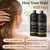 Batana Oil Hair Growth Shampoo & Conditioner Set for Dry, Damaged Hair