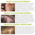 RHRI Folliculitis Shampoo Antifungal for Psoriasis, Dandruff & Itchy Scalp