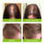 Svvimer Hair Boost Spray - with Rosemary Batana Oil Biotin for Hair Loss and Thinning - Thicker Fuller Longer - for Women and Men 2.7 Fl Oz (Pack of 1)" since unit on hand is Hair Boost Spray.