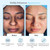 Glycolic Acid 50% Gel Peel - Enhanced with Retinol & Green Tea Extract (Professional Skin Peel)1 ounce