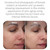 Epionce Renewal Facial Cream Hydrating Anti-Aging Skin Barrier Moisturizer