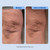 Plexaderm 1% Retinol Firming Cream - Fights Wrinkles & Crepey Skin