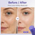 AgeVance PeptiLift LAB™ Peptide Anti-Wrinkle Roller Cream (2PCS)