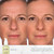 NassifMD Hydro-Screen Serum Hyaluronic Acid Ceramides Retinol Firming