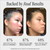 Brandefy No Needles Niacinamide Peptide + Hyaluronic Acid Face Serum
